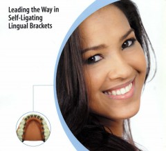 Ortodoncia Lingual