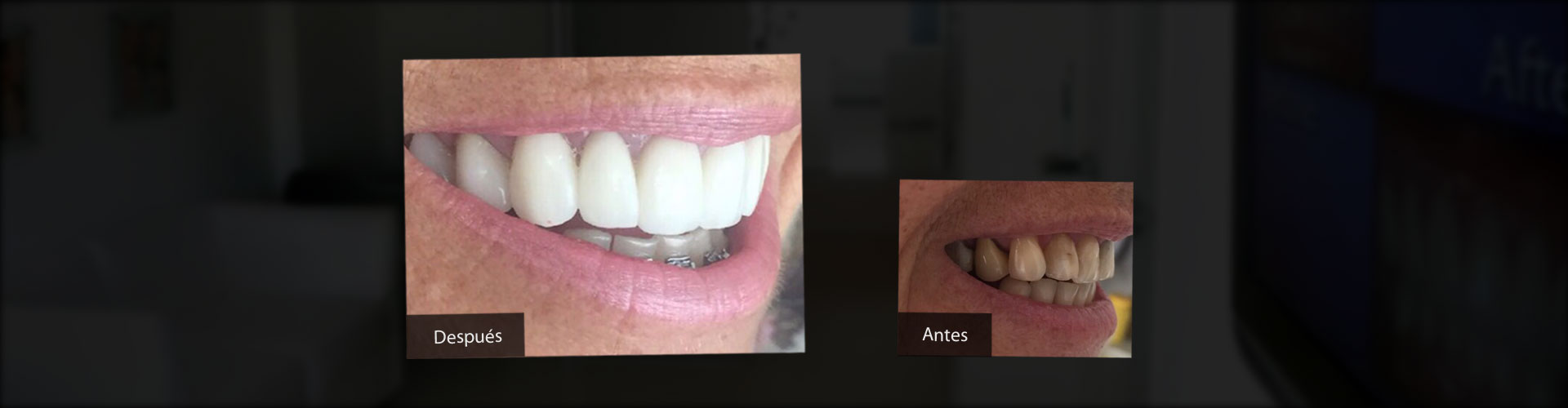 Implantes Dentales, Estética Dental, Ortodoncia