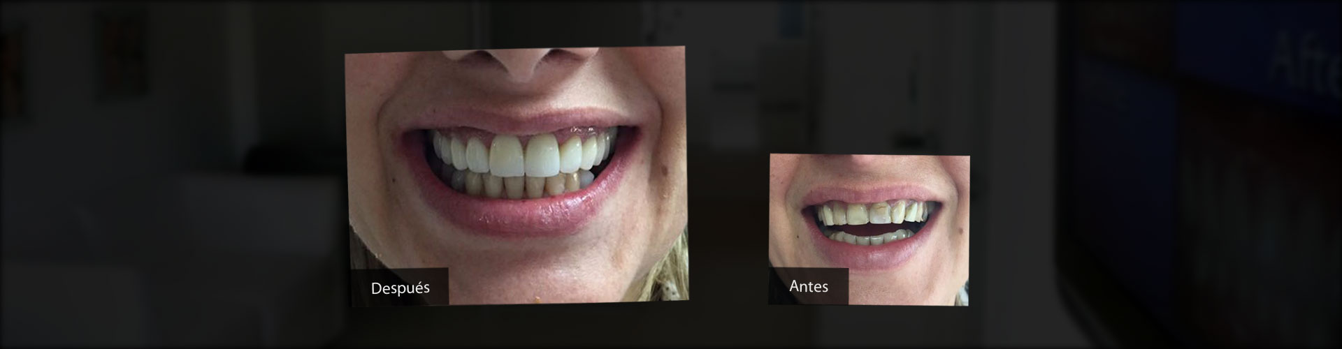 Implantes Dentales, Estética Dental, Ortodoncia