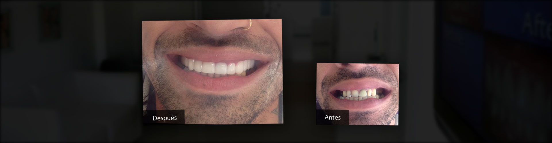 Implantes Dentales, Estética Dental, Ortodoncia