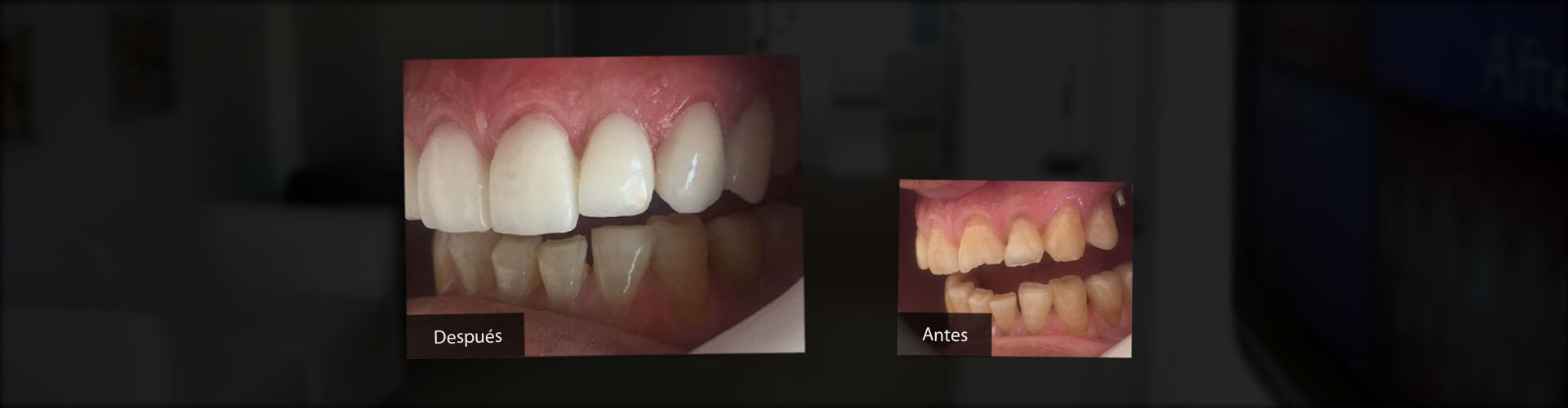 Implantes Dentales, Estética Dental, Ortodoncia