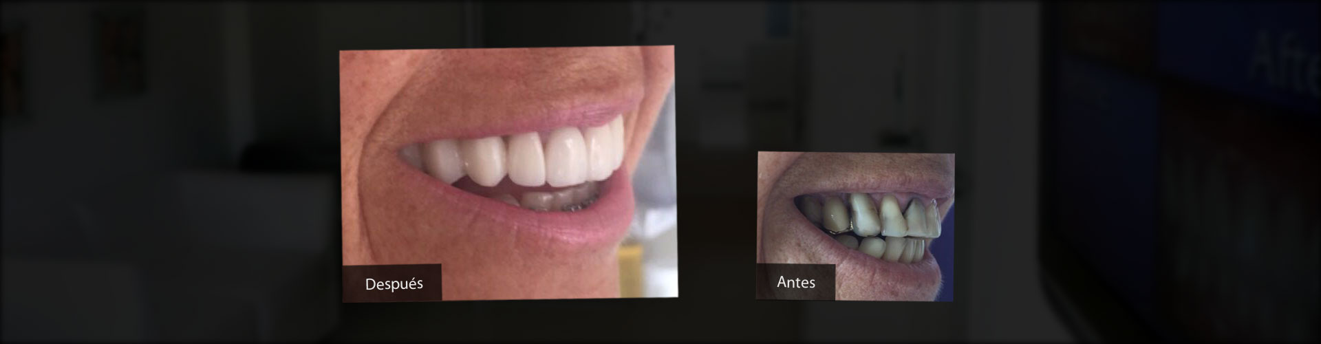 Implantes Dentales, Estética Dental, Ortodoncia